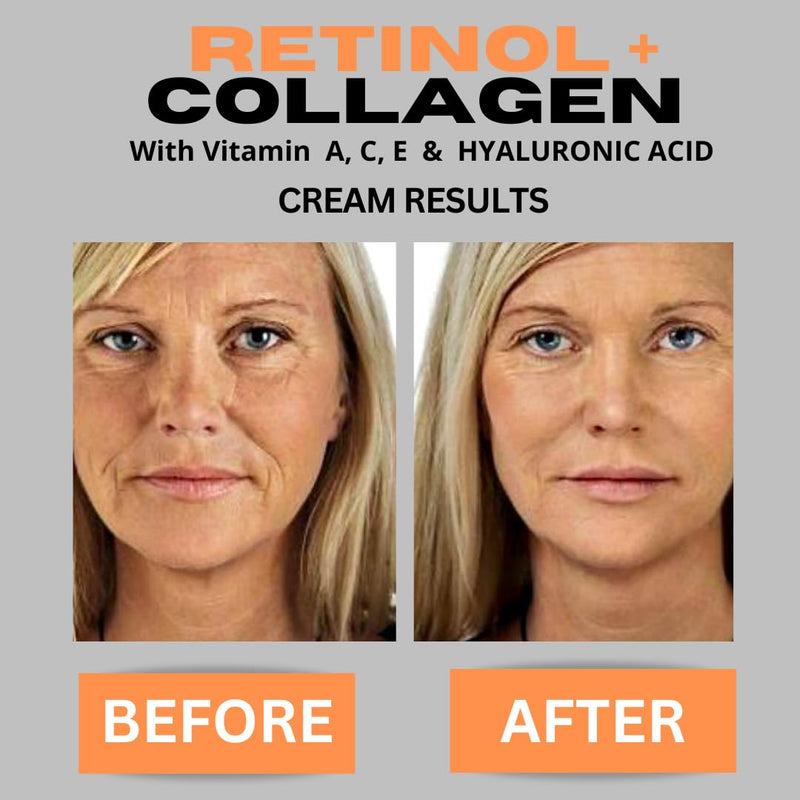 Retinol + Collagen, Hyaluronic Acid, Vitamin C Anti-Aging Face Cream, Day and Night Moisturizing Cream, Anti-Wrinkle Cream for Face, Firming Cream - 4oz