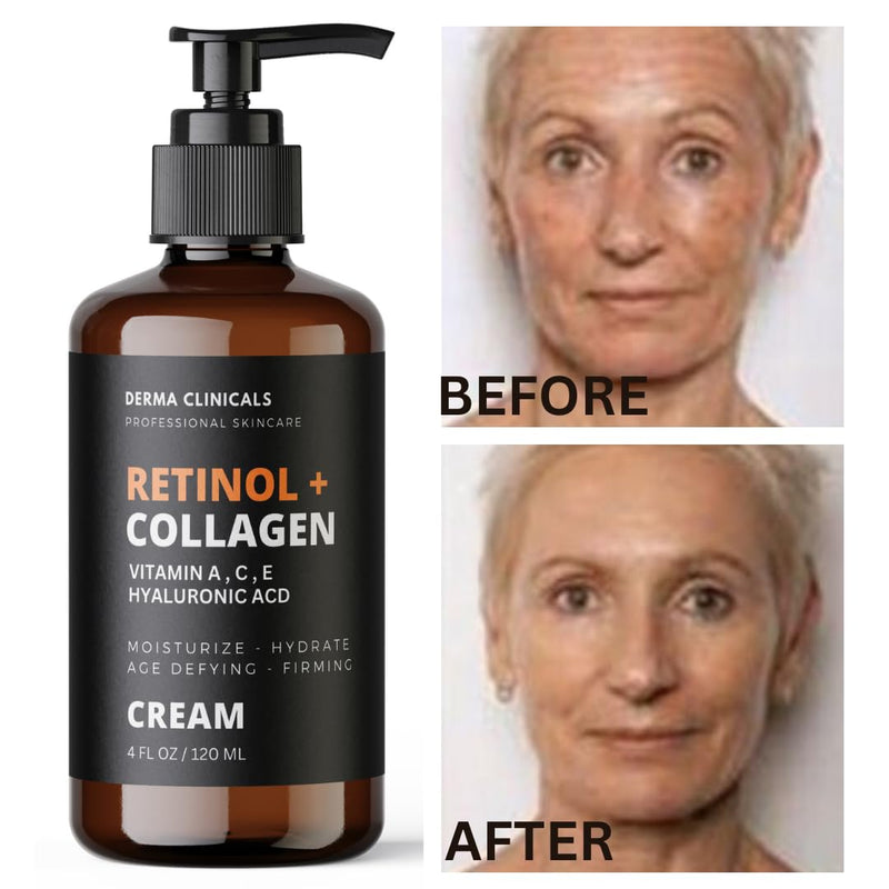 Retinol + Collagen, Hyaluronic Acid, Vitamin C Anti-Aging Face Cream, Day and Night Moisturizing Cream, Anti-Wrinkle Cream for Face, Firming Cream - 4oz