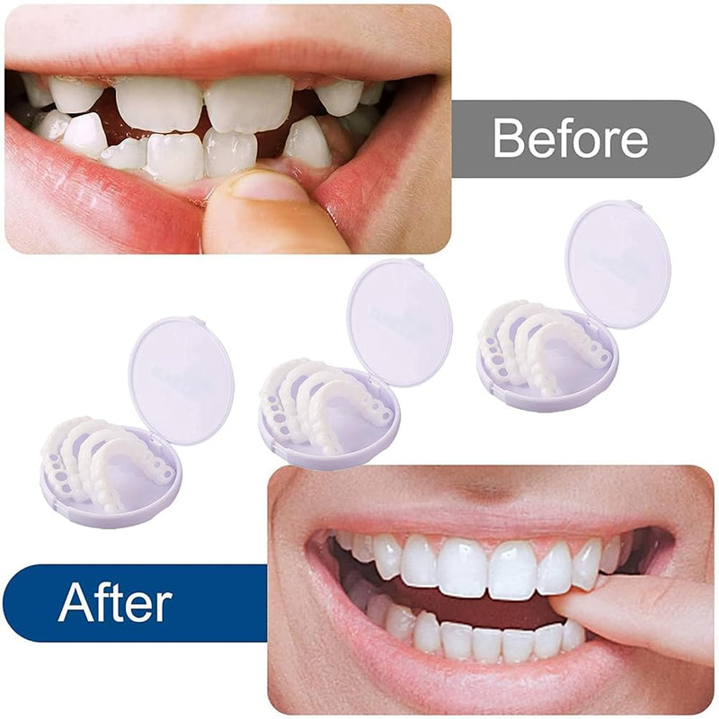 [Australia] - Prostheses Fake Teeth, 5 Pairs False Artificial Teeth Braces Smile Veneers Cosmetic Temporary Teeth Dentures Prosthesis Artificial Veneers Teeth Top and Bottom 
