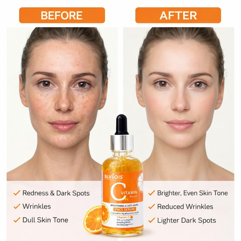 Vitamin C Serum For Face – Anti Aging Formula with Vitamin C, Hyaluronic Acid, Vitamin E – Brightening Serum – Improve Appearance of Dark Spots, Tone, Fine Lines & Wrinkles, Orange 1.69 Fl Oz (Pack of 1)