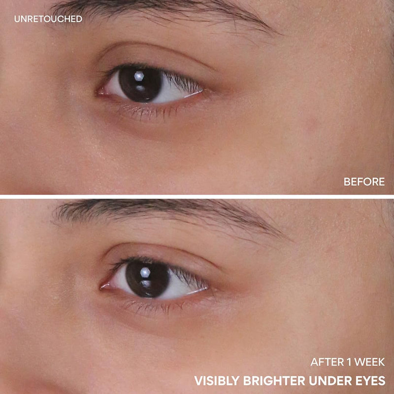 innisfree Vitamin C Niacinamide Eye Serum | Korean Eye Serum to Improve Dark Under Eye Circles | Eye Roll On Serum For All Skin Types