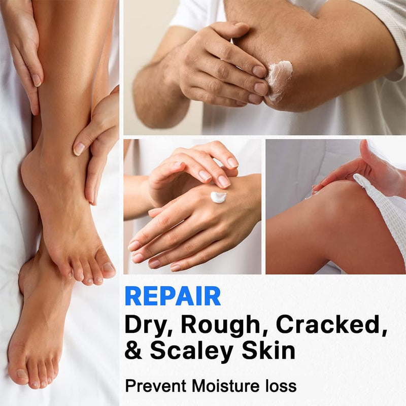 [Australia] - Urea Cream 40%, Keratolytic Foot Cream for Dry Cracked Heels, Feet, Knees, Elbows, Hands, Cuticle, Callus Remover, Skin Barrier Repair (3) 
