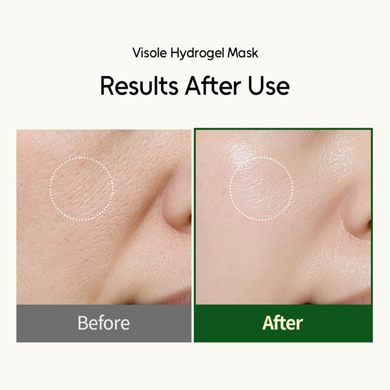 Hydrogel Face Mask 4 Pack - Niacinamide, Bakuchiol, Glutathione, 8 Vitamins - Anti-Aging Hydrating Korean Sheet Mask for Radiant Skin | K-Beauty | 1.05oz x 4ea