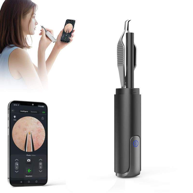 Blackhead Removal Tweezer with 1080p Camera, Ultimate Precision: Blackhead Removal with Camera - Perfect for Delicate Tasks! - - Ingrown Hair, Ear Hair Tweezer (Black) Black