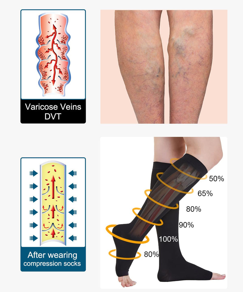 [Australia] - Open Toe Medical Compression Stockings Women & Men 20-30 mmHg Class 2, Size S-4XL, Compression Socks Support Stockings for Varicose Veins Edema Flight XXL Black 