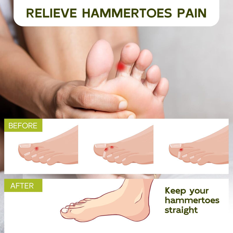 [Australia] - Bukihome Hammer Toe Straightener - Reusable Fabric Toe Wraps Protect and Straighten Hammertoes - Toe Corrector for Men and Women - Realign Bent, Curled, Crooked, Claw, Hammer Toes (Dark Gray, 6 Pack) Dark Gray Pack of 6 