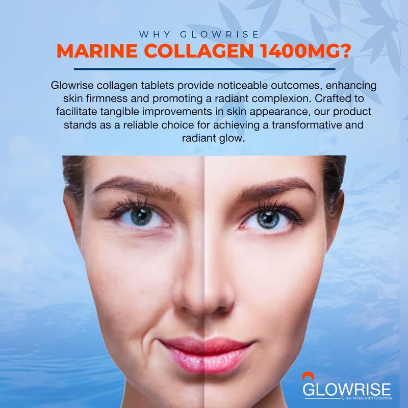 Marine Collagen Tablets 1400mg – 120 Tablets (2 Month Supply) with Hyaluronic Acid, Biotin, Vitamin C & E – Collagen Supplement for Skin, Hair & Joints – for Women & Men 1