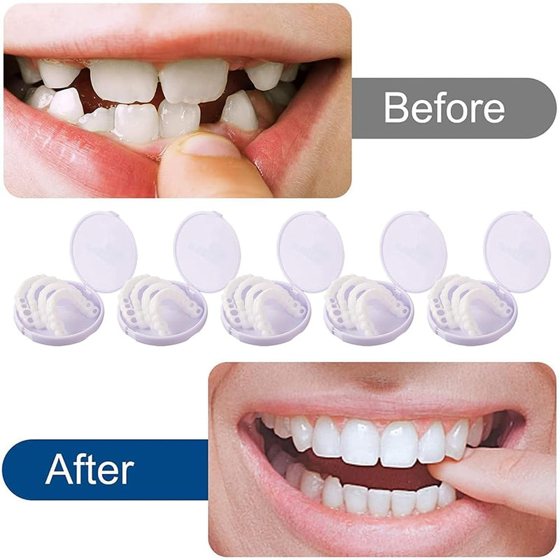 [Australia] - Prostheses Fake Teeth, 5 Pairs False Artificial Teeth Braces Smile Veneers Cosmetic Temporary Teeth Dentures Prosthesis Artificial Veneers Teeth Top and Bottom 
