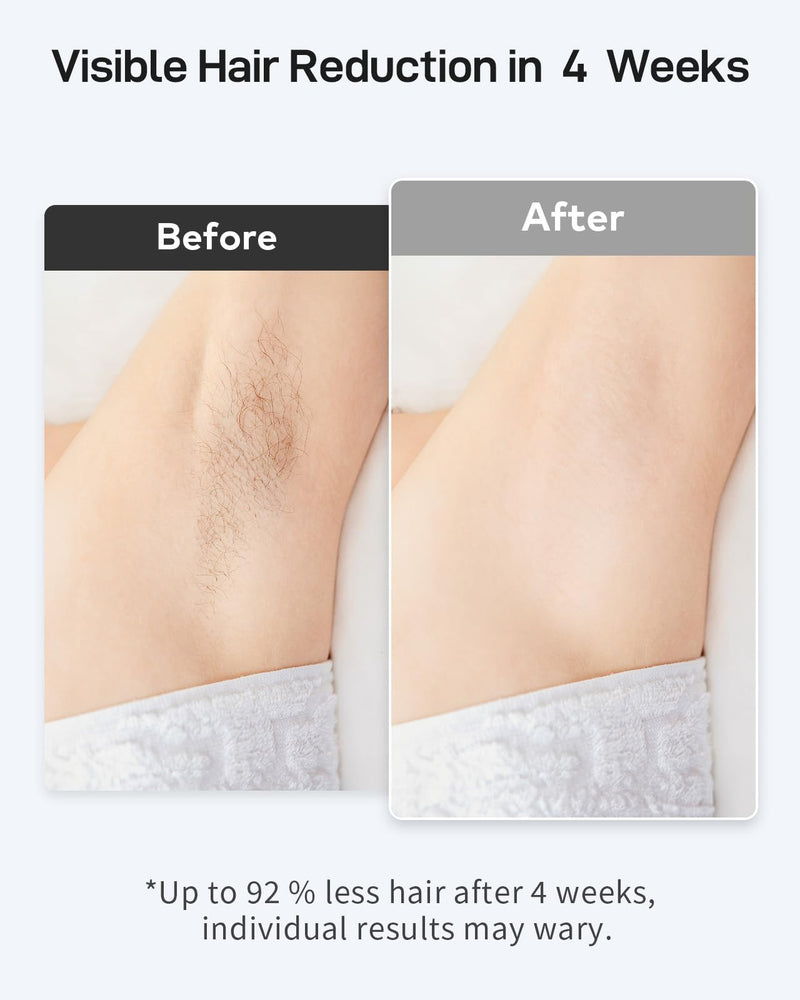 [Australia] - IPL Laser Hair Removal for Women and Men, Ice-Cooling Laser Hair Removal Device Safe at-Home Epilators for Face Armpits Arms Bikini Line Legs Whole Body KA10 