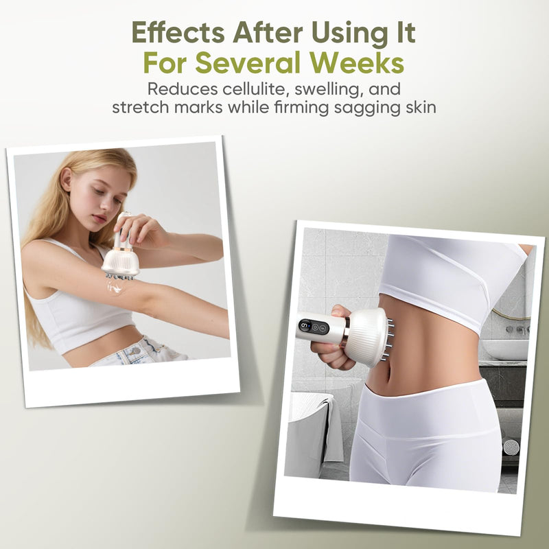 [Australia] - Body Sculpting Machine — Lymphatic Drainage Massager & Anti Cellulite Massage Tool,with Microcurrent, Light Heat & Vibration for Legs, Arms & Belly, Body,Helps Reduce Stretch Marks & Cellulite White 