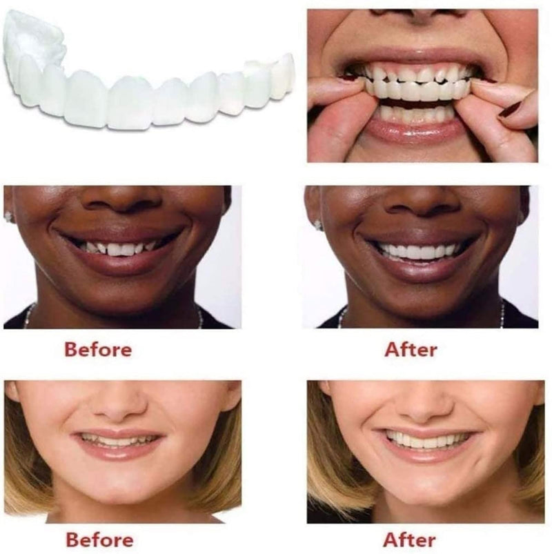 [Australia] - 2 PCS，Temporary Adjustable for Men and Women Nature and Comfortable to Confident Smile 