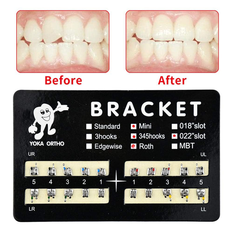 60Pcs Tooth Brace Teeth Model Mini Roth Brackets Roth 022 Slot Bondable with Hook on 347 (60pcs-Black) 60pcs-Black