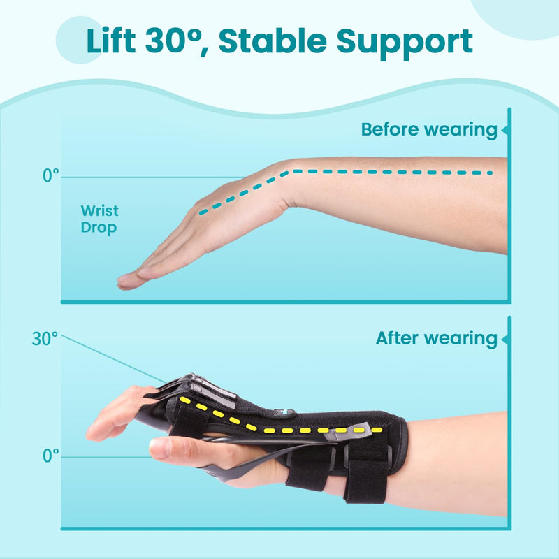 [Australia] - Radial Nerve Palsy Splint Brace for Wrist drop, 5 Fingers Extension, Stroke Patient Recovery, Finger Limp, Crutch Palsy, MCP Arthroplasty, for both Left and Right Hand - Black 