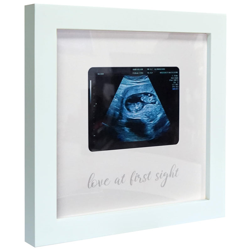 [Australia] - Love at First Sight Ultrasound Picture Frames, Sonogram Picture Frame, Pregnancy Announcement for Grandparents, Baby Announcement Ideas Ultrasound Photo Frame Nursery Décor, White Love at First Sight - White 