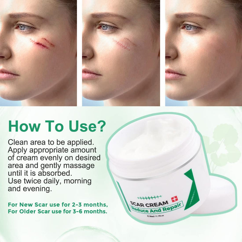 [Australia] - Scar cream, scar removal cream, advanced scar treatment gel for surgical scars, acne scars, effective for old and new scars 