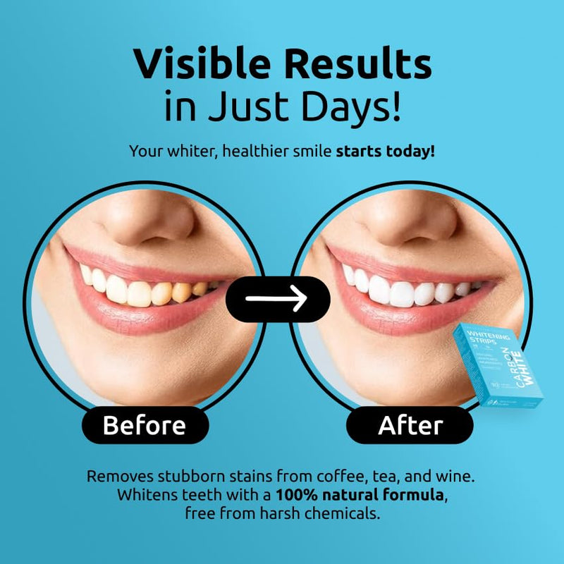 [Australia] - Carbon White Teeth Whitening Strips – 28 Count (14 Treatments) – Enamel-Safe, for Sensitive Teeth – Mint Flavor – Non-Slip Whitening Kit 