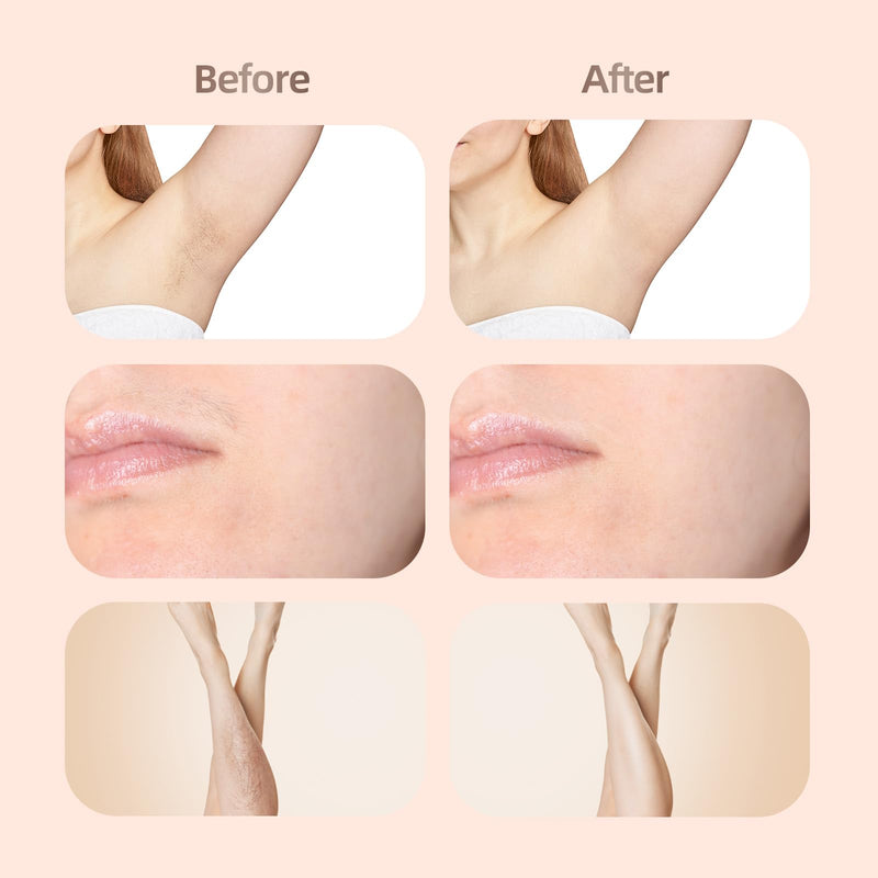 [Australia] - 2 in 1 Women Electric Shaver, Bikini Trimmer for Women Dual Head Wet & Dry Use IPX7 Waterproof, Body Hair Trimmer and Facial Hair Remover for Bikini Underarm Leg Arm Body Face (Rose Gold) Rose Gold 