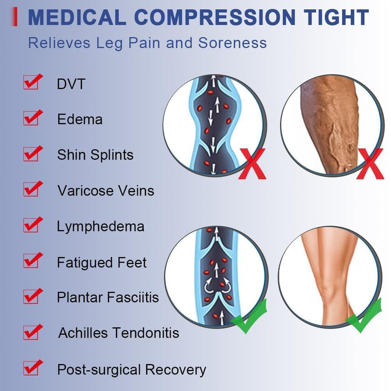 [Australia] - beister Medical Compression Pantyhose Women & Men,20-30mmHg Open Toe Thigh High Compression Tights Graduated Support Black X-Large 