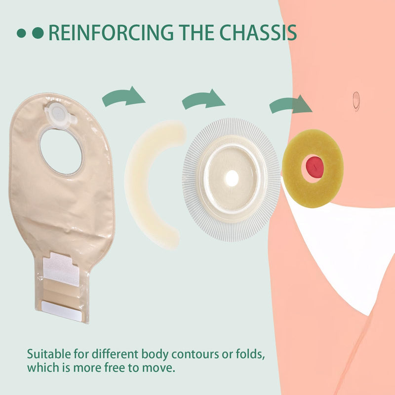 [Australia] - 30 Pcs Elastic Ostomy Barrier Strips, Ostomy Skin Supplies, Medical Grade Skin-Friendly Leak-Proof Adhesive, Hydrocolloid Tape for Colostomy Ileostomy Urostomy Bags 