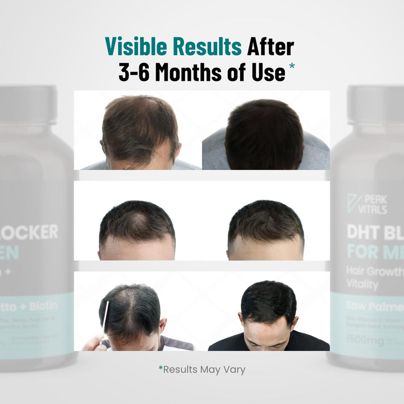 [Australia] - DHT Blocker for Men | Ultra Potent Hair Growth Formula | Saw Palmetto, Biotin, Pumpkin Seed, Herbal Extracts | Natural Hair Loss Supplements | Hair Regrowth Vitamins | Made in The USA | 90 Capsules 