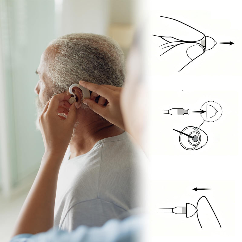 Hearing Aid Domes for Oticon Replacements,Biluer 20 PCS 8mm Oticon Hearing Aid Domes Self Replaceable Hearing Aid Earplugs Suitable for Power Minifit