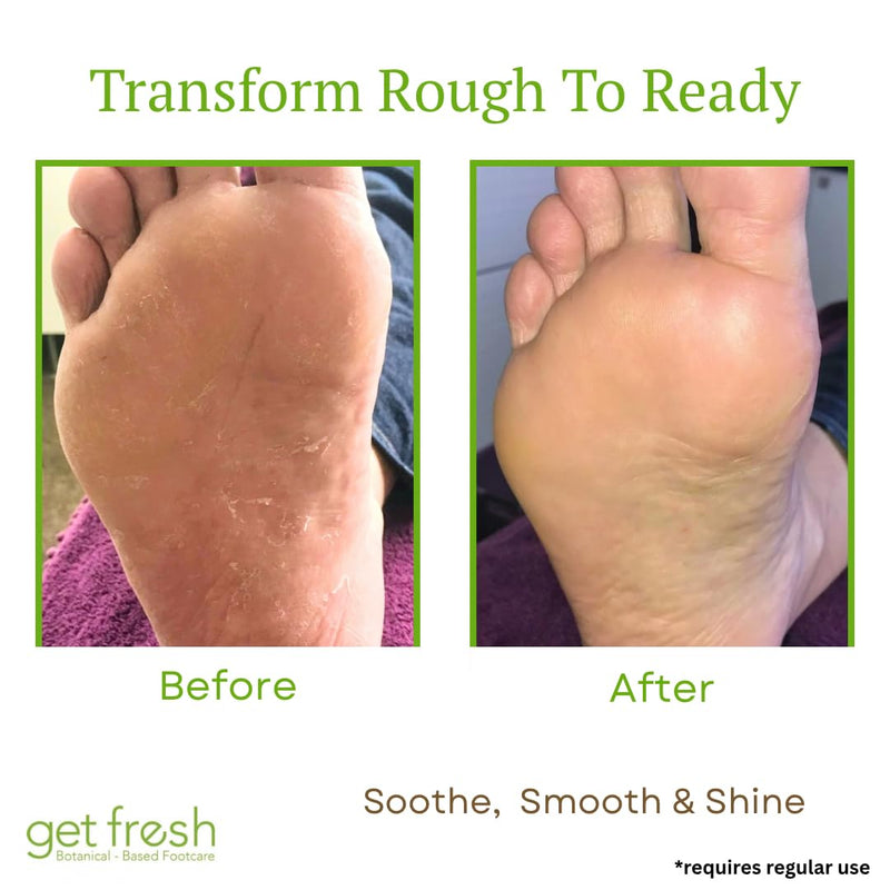 Get Fresh Rescue Me - Intensive Foot Cream for Dry Skin, Cracked Heels, and Calluses, with Shea Butter, Aloe, and Lemongrass, 170g