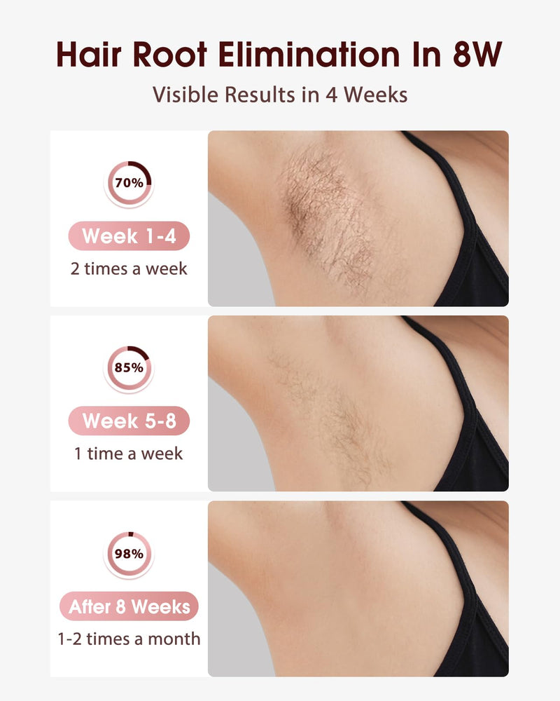 [Australia] - LYSMOSKI Laser Hair Removal, IPL Hair Removal with Ice-Cooling System for Painless & Long-Lasting Result, Safe At-Home Hair Remover Device for Armpits Back Legs Arms Face Bikini Line, Rose Gold 