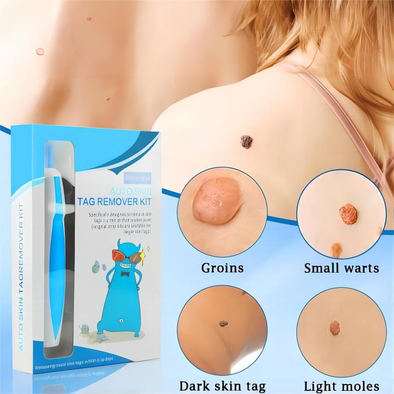 [Australia] - Micro Skin Tag Remover, Skin Tag Birthmark Remover, Auto Skin Tag Remover Kit, Stalk Wart Removal Quick Kit, Skin Tag Removal Pen, Wart Remover for Micro to Large (1-8 mm) 