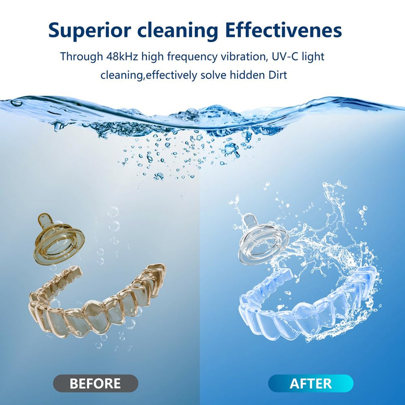 [Australia] - 500ML Capacity 48kHz, Updated Version Ultrasonic Retainer Cleaner, Multi-Functional Cleaner Machine For Dentures, Mouth Guards, Braces, Toothbrush, Jewelry, Glasses with Alam Clock Function, (white) 