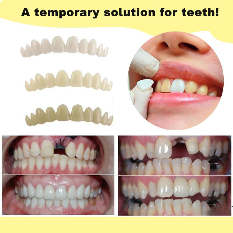 [Australia] - Dental repair kit - fix the lost teeth and broken teeth quickly restore a confident smile. The perfect tooth combination of 3 colors makes it look more natural. 