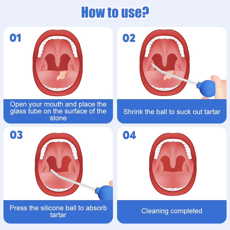 [Australia] - Riisoyu Tonsil Stone Removal Tool, Tonsilclin Tonsil Stone Cupping Glass with Suction Pipette Cupping Head Dental Mirror Tonsil Stone Remover for Bad Breath Oral Care Fresh Breath 