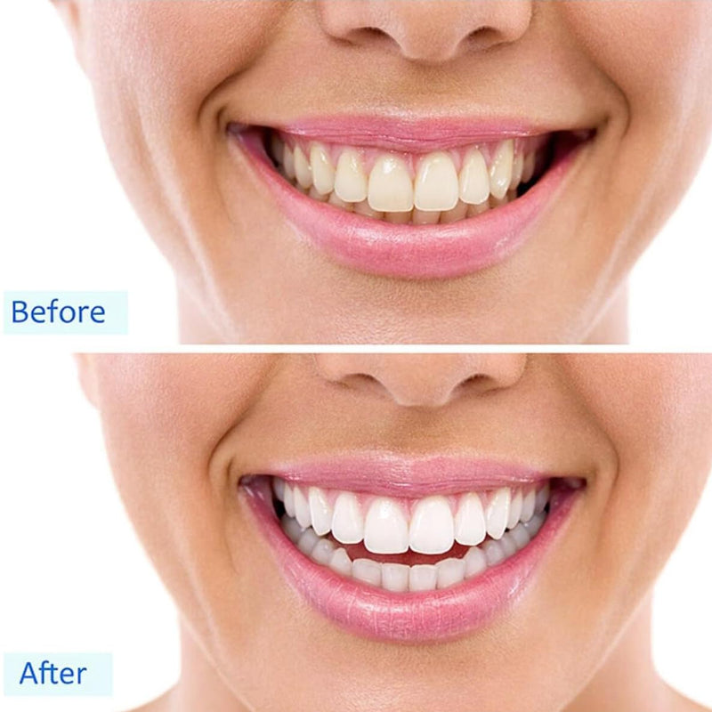 [Australia] - 32 LED Teeth Whitening Accelerator Light with Cold Light &Red Lights Trays Device, Teeth Whitening Enhancer Light Built-in 16 Minute Timer (White) White 