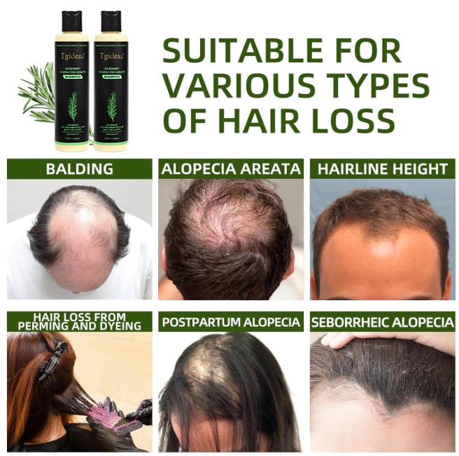 Rosemary Biotin Volumizing Shampoo for Thinning Hair, 7.4 Fl Oz | Keratin Strengthening, Helps Boost Volume, Reduce Breakage, Nourishes Scalp, Color-Treated Hair Safe Vegan, Gentle Daily Care Shampoo*1(7.4 Fl Oz)