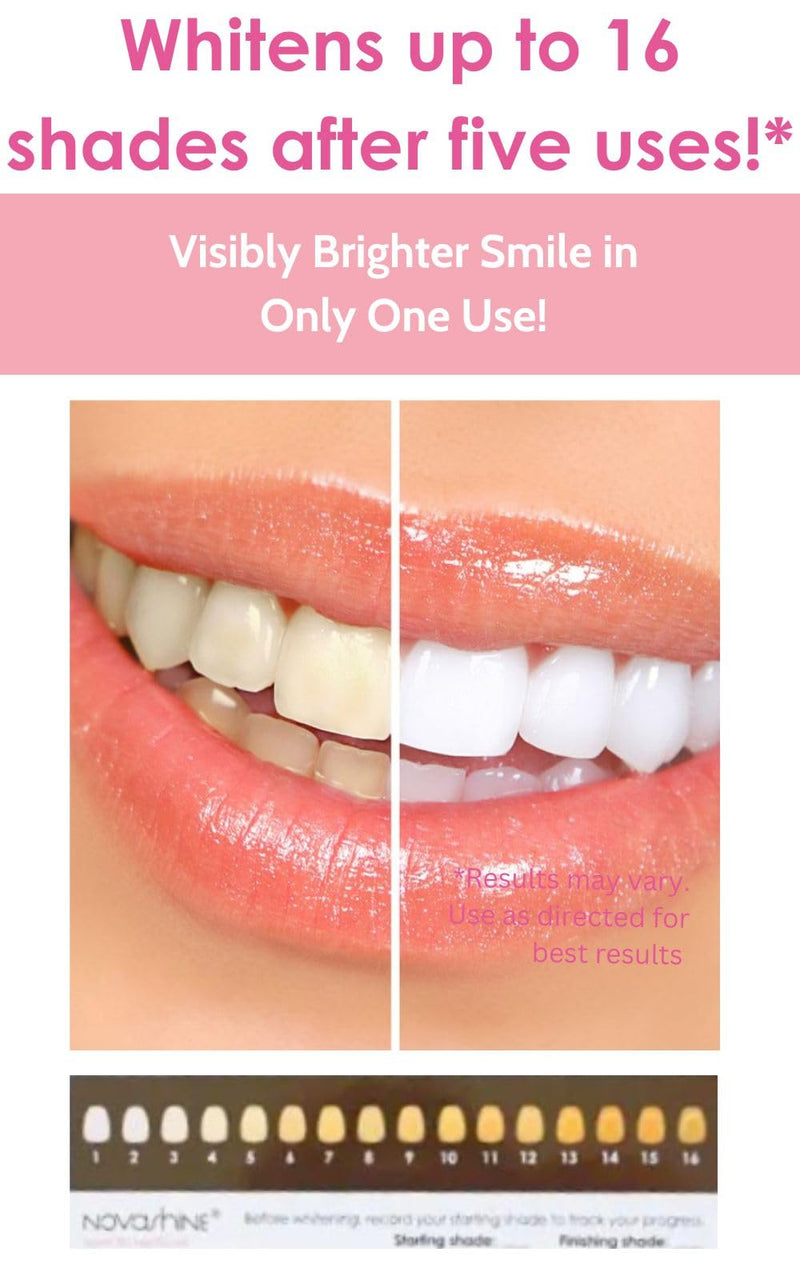 Novashine Professional Teeth Whitening Kit: Advanced Blue LED Light, Concentrated Peroxide Gel, Smartphone Adapter, Travel Bag