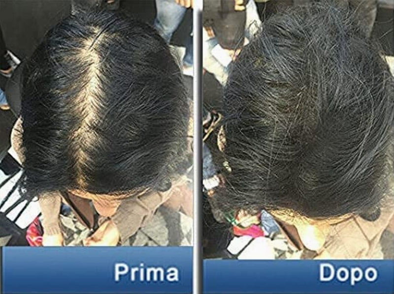 Pantogar Specific Treatment for Hair and Nails 90 caps