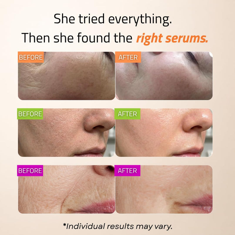 GLEOW Skincare Set: Retinol, Vitamin C, and 99% Hyaluronic Acid Serum, Face Serum Set Targets Appearance of Uneven Skin and Dryness, Total Package Serum Set 3x2 oz Combo pack 2oz