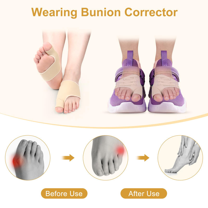 [Australia] - MXTIMWAN 2 Pairs of Hallux Valgus Socks, Beige Hallux Valgus Correction Big Toe & Toe Relief Forefoot Pad Splint, Bunion for Hammer Toe Pain Relief for Men & Women, Size L 