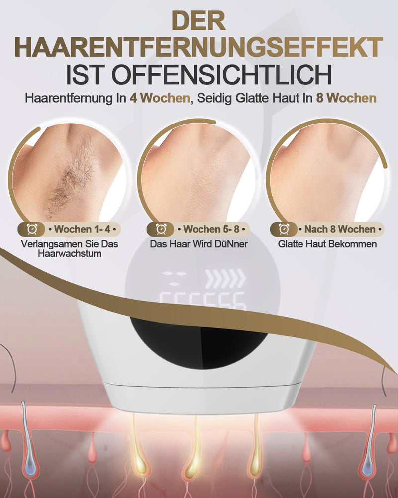 [Australia] - IPL device hair removal laser, 999,999 light pulses laser hair removal & 5 energy levels, automatic and manual mode, efficient laser painless result, for armpits, legs white 