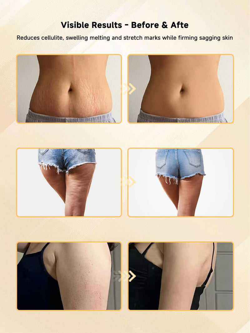 [Australia] - Body Sculpting Machine, Lymphatic Drainage Massager & Anti Cellulite Massage Tool, Helps Reduce Stretch Marks & Cellulite, Pain Relief Devices for Sciatica Nerve, Legs, Arms, Hip, Muscle & Lower Back 