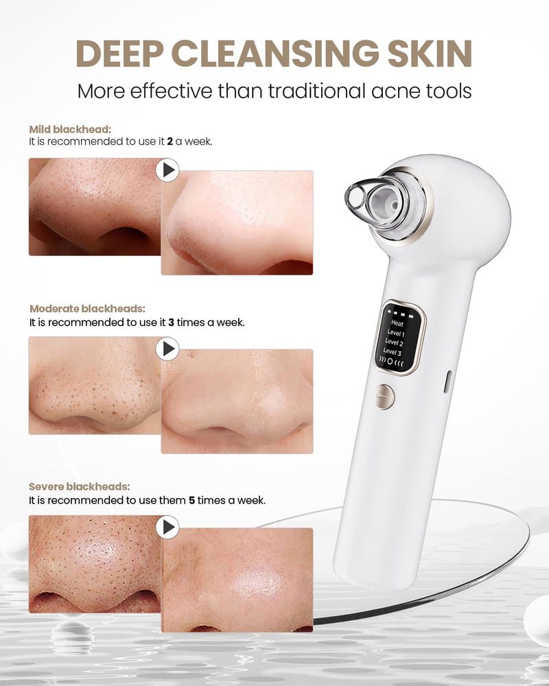 Pore Vacuum Blackhead Remover Kit - 5 Suction Heads & Extractor Tools, 3 Adjustable Suction Levels - Facial Pore Cleansing for Women&Men (White) White