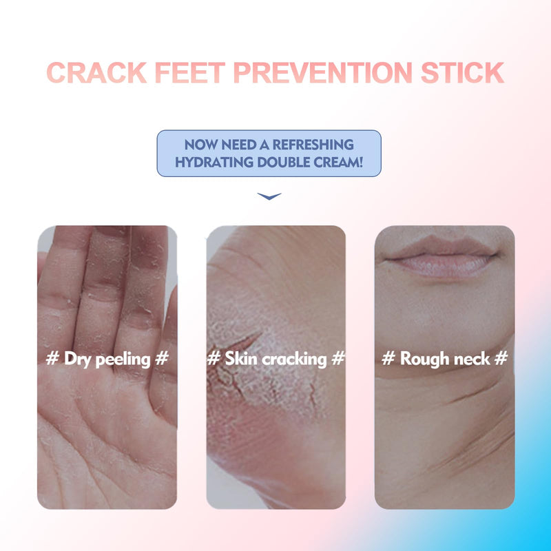 [Australia] - Crack Feet Prevention Stick, Foot Balm, Crack Heel Cream -Smooth Protective BalM, Foot Balm for Dry Cracked Feet, Refreshing, Hydrating, Deep Moisturizing (Pink+Blue, one size) Pink+Blue 1.41 Fl Oz (Pack of 1) 