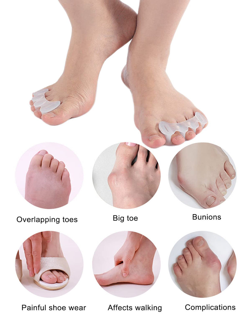 [Australia] - 2Pairs Toe Separators Toe Spacers for Women Men to Correct Bunion, Relieve Feet Pain, Foot Alignment, Toe Straighteners for Hammertoes, Plantar Fasciitis (M, Women Shoe Size 9-12.5, Men: 7-11) M, Women Shoe Size 9-12.5, Men: 7-11 