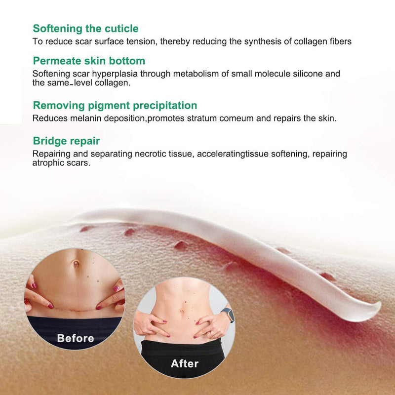 [Australia] - Scar cream, scar removal cream, advanced scar treatment gel for surgical scars, acne scars, effective for old and new scars 