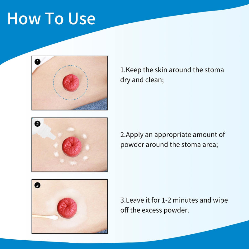 [Australia] - 30g Stoma Powder, Ostomy Skin Care Powder, Protects Skin Keep Dry Ostomy Powder Stoma Powder（4 Boxes） 