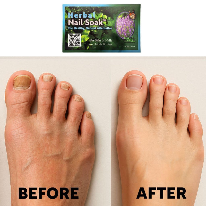 Long Creek Herbs Nail Soak 100 Percent Natural Hand and Foot Soak | Professional nail care, salon-quality results, home or studio, strengthens nails and softens skin, herbal nail soak 1 Count (Pack of 1)