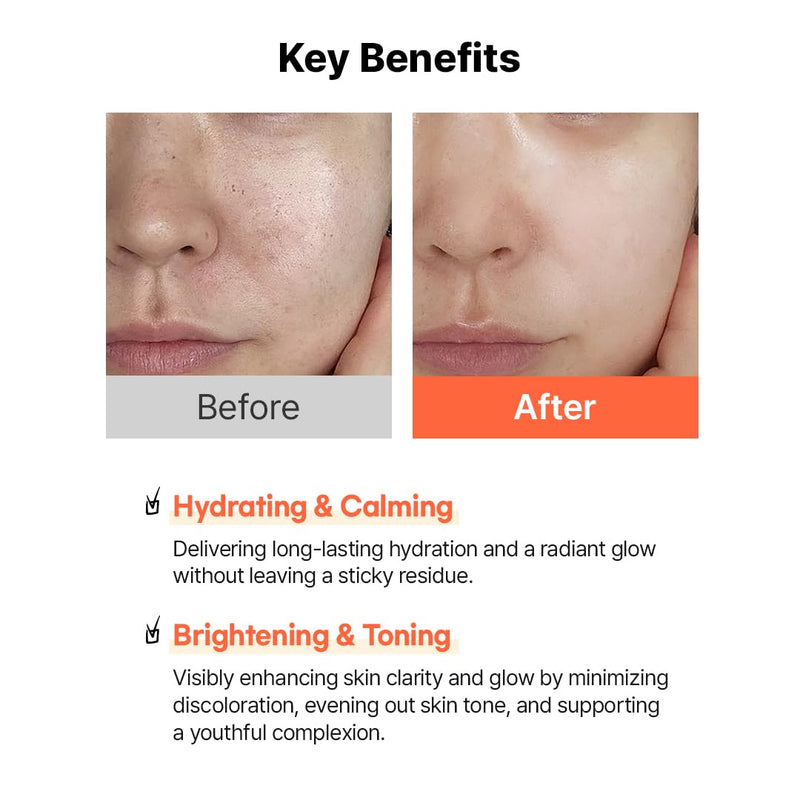 Hanskin Vitamin C Glow Sheet Mask – Korean Brightening & Hydrating Face Mask with Vitamin C + Niacinamide for Radiant, Even-Toned Skin | Glowing, Revitalizing Serum Mask | 10EA