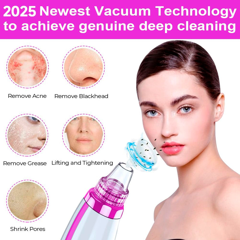 Blackhead Remover Pore Vacuum Upgraded Facial Pore Cleaner Electric Comedone Whitehead Extractor Tool, Blackhead Vacuum Kit for Women & Men