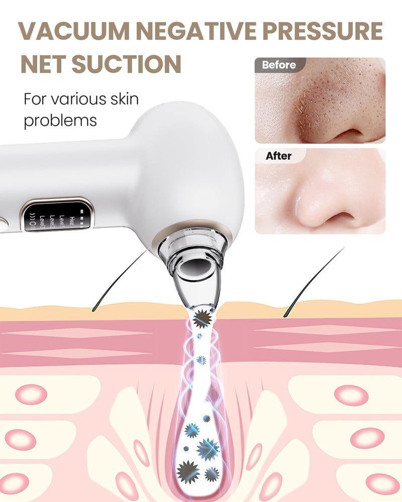 Pore Vacuum Blackhead Remover Kit - 5 Suction Heads & Extractor Tools, 3 Adjustable Suction Levels - Facial Pore Cleansing for Women&Men (White) White