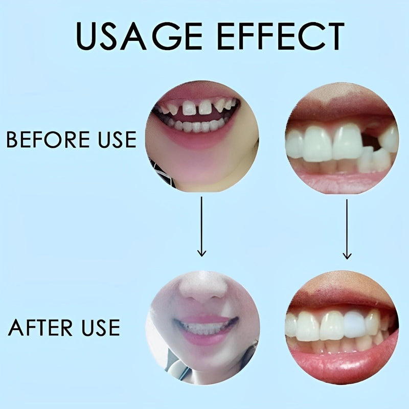[Australia] - 2 Pairs,Regain Confidence Smile,Adjustable for Men and Women,Beautiful Smile(White) 