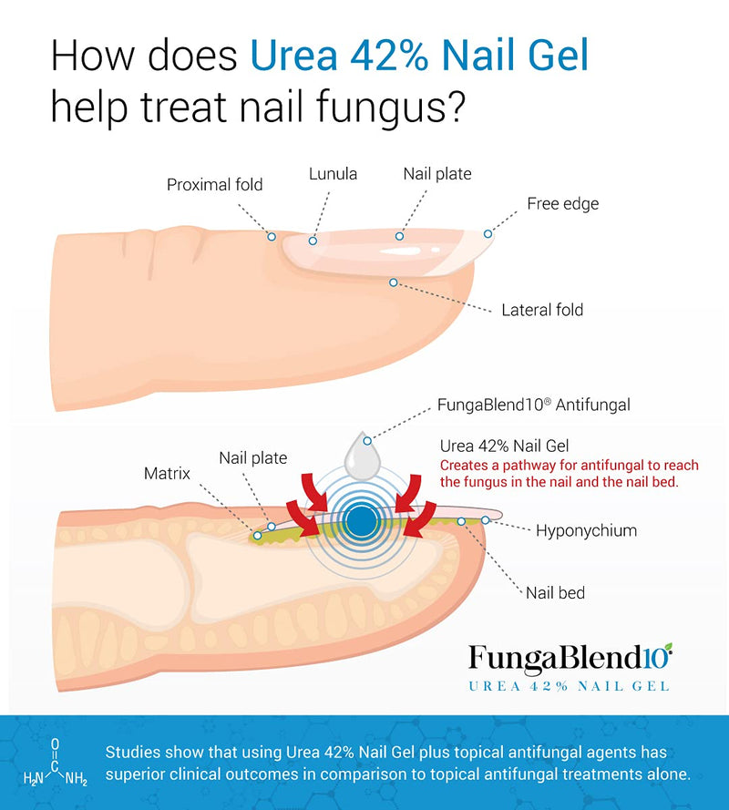 FungaBlend 10 - Urea 42% Nail Gel to Cure Fungus Faster - Delivers Antifungal Medication Directly to Fungus - Quick Results Topical Solution for Toe and Finger Nail Repair Treatment
